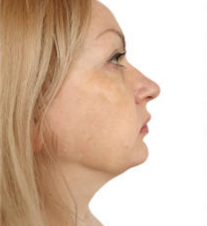 Introducing The Kind Rewind EMS Facial Toning Device