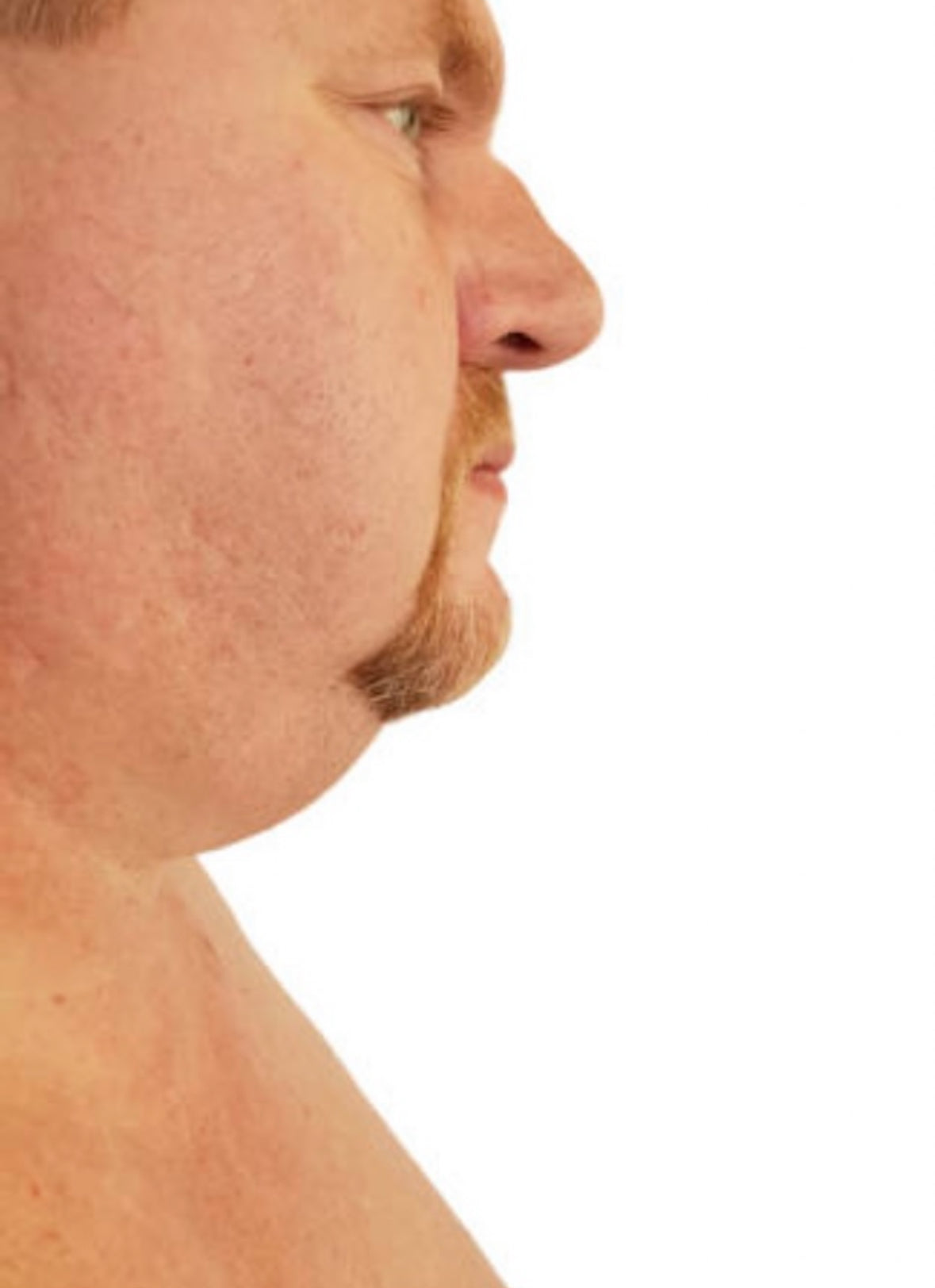 Introducing The Kind Rewind EMS Facial Toning Device